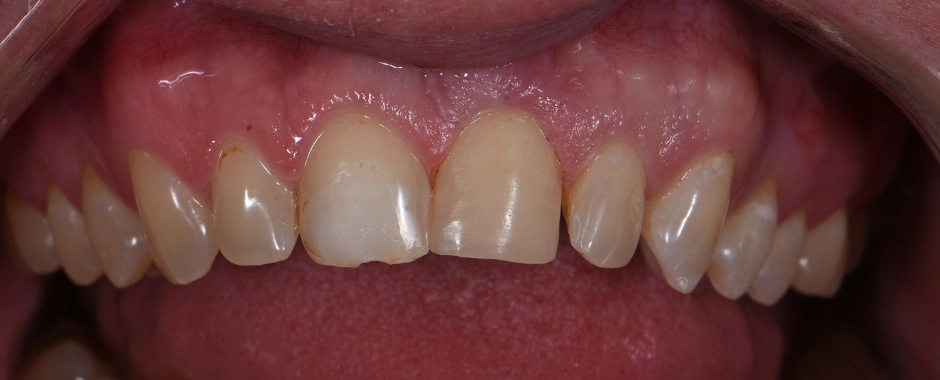 Chintan Patel DMD After