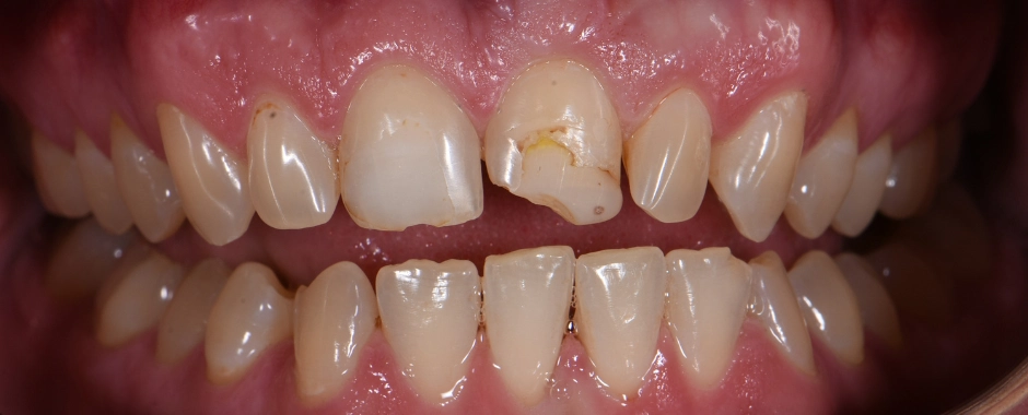 Chintan Patel DMD Before