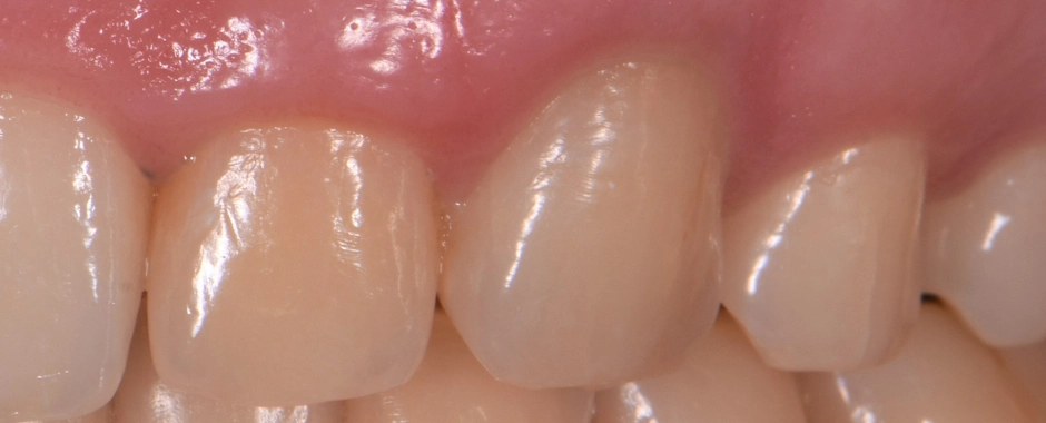 FLD - Allyson Ryan After