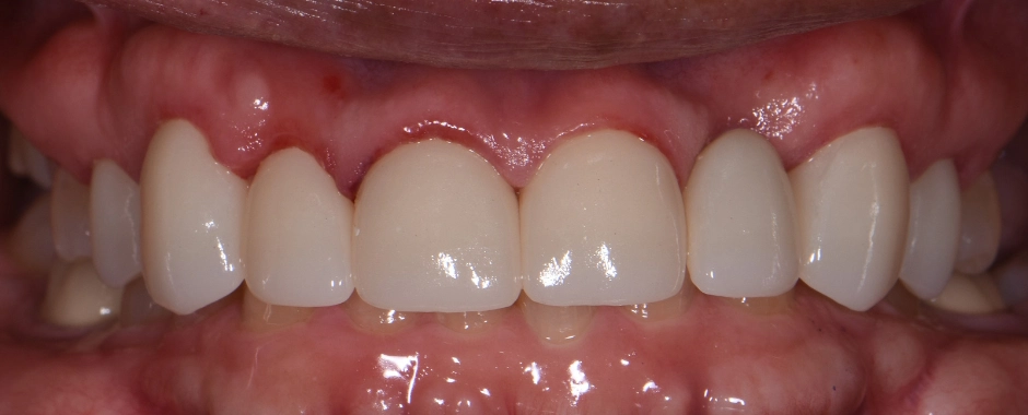 WFD - Kelly Crowe WM After