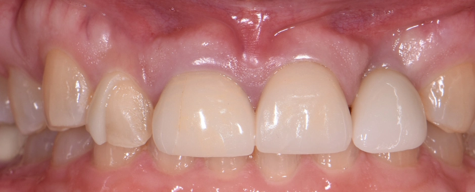 WFD - Kelly Crowe WM Before