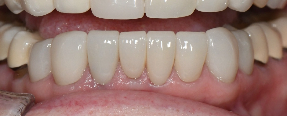 WFD - Myra Vick After