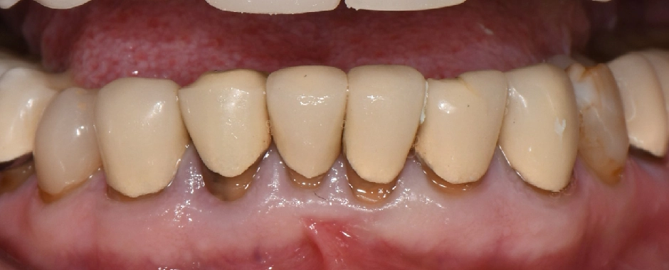 WFD - Myra Vick Before