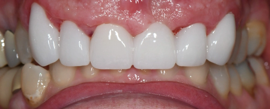 WFD -Tammie Horgan After