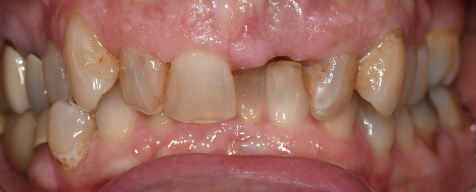 WFD -Tammie Horgan Before